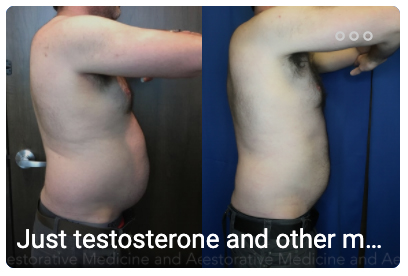 Asheville bioidentical hormone replacement therapy model before and after