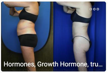 Asheville bioidentical hormone replacement therapy model before and after