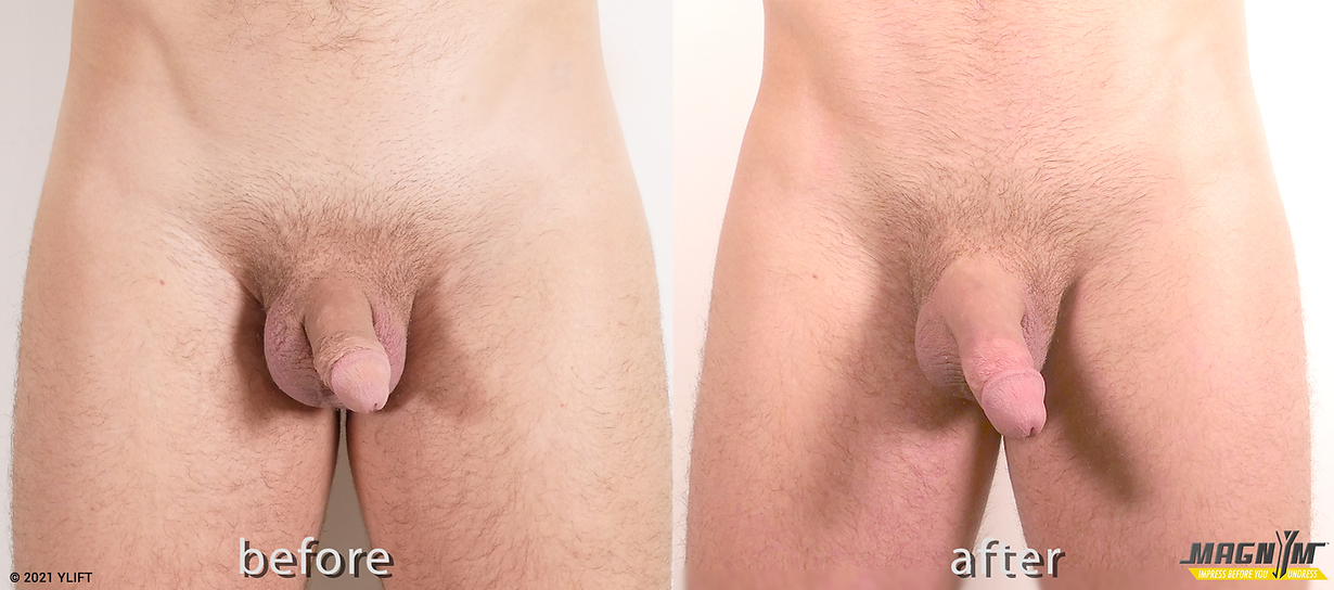 Asheville Magnym Male Enhancement model before and after