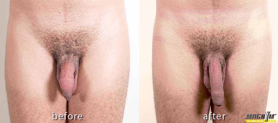 Asheville Magnym Male Enhancement model before and after